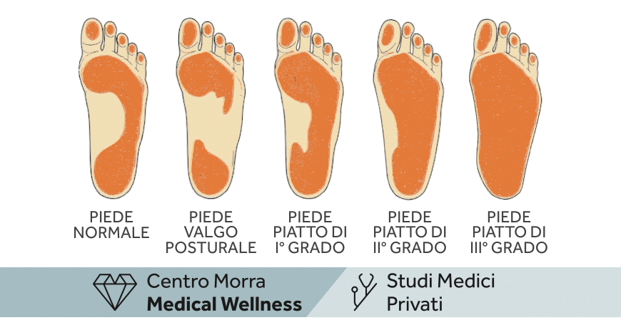 Podologia pediatrica Napoli | Dott.ssa Dr. Luca Orlando .